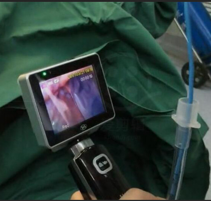 ICU EMS सिंगल यूज इंटुबैषेण वीडियो लैरींगोस्कोप 1280 X 720 कैमरा रेजोल्यूशन के साथ