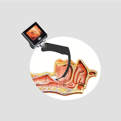 USB 32GB एनेस्थीसिया हैंडहेल्ड वीडियो लैरींगोस्कोप HYHJ-KC